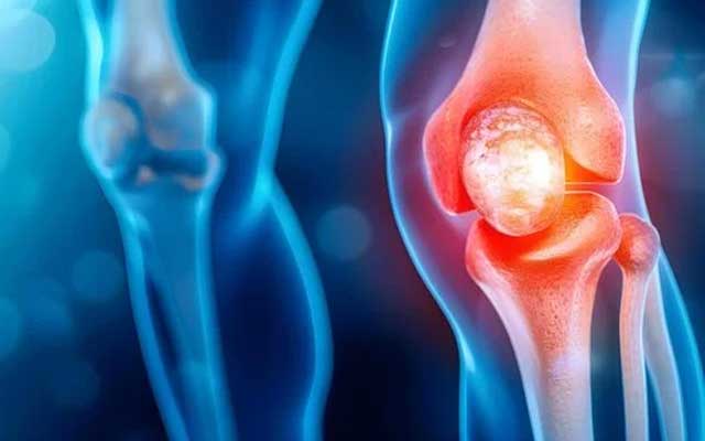 Care of Bones & Joints